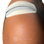 Silicone Shoulder Pad Cushion 1 Pair, Nude